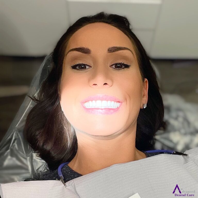 advanced dental care costa mesa