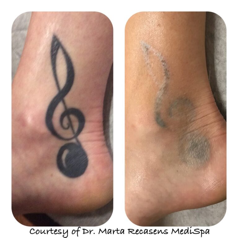 marta recasens medispa glendale 5