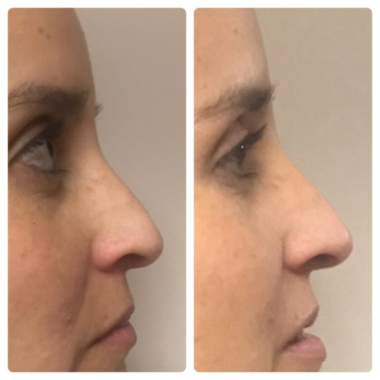 marta recasens medispa glendale 5