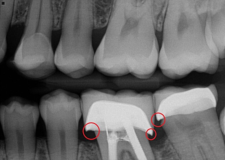 advanced dental care of silicon valley santa clara 2