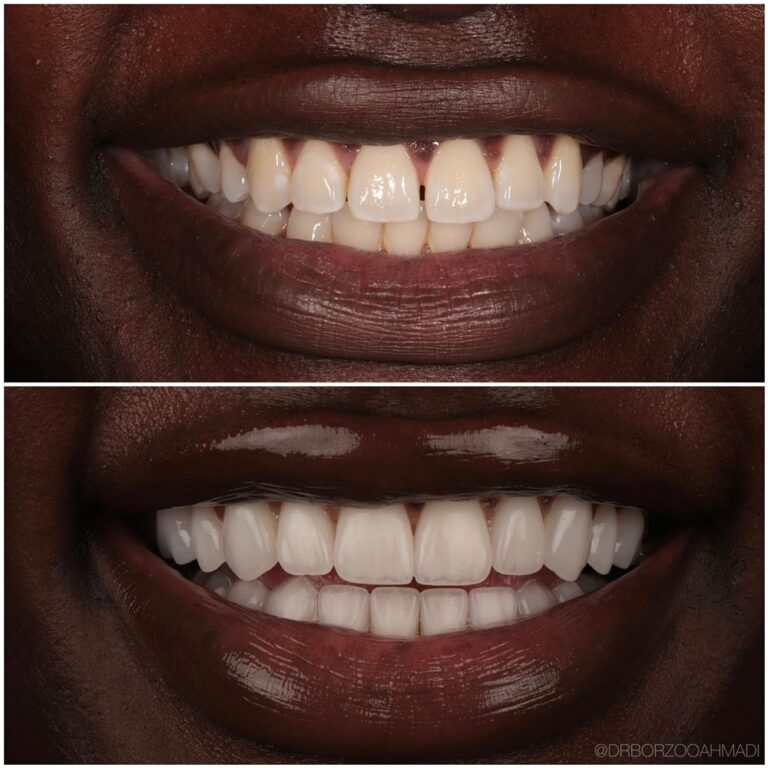 borzoo ahmadi dds beverly hills west hollywood 3