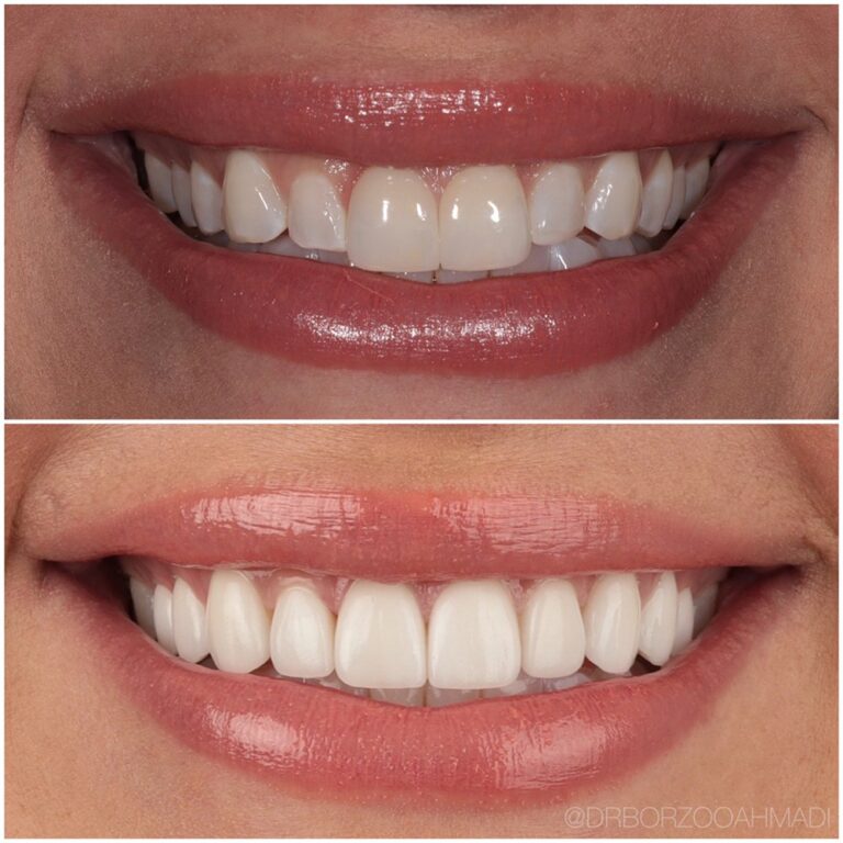 borzoo ahmadi dds beverly hills west hollywood 3