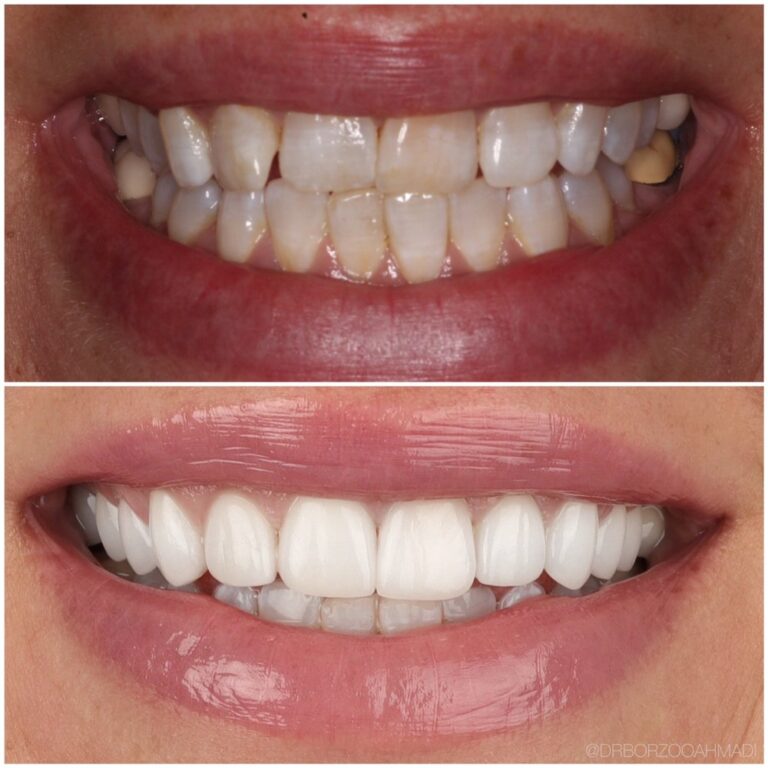 borzoo ahmadi dds beverly hills west hollywood 3