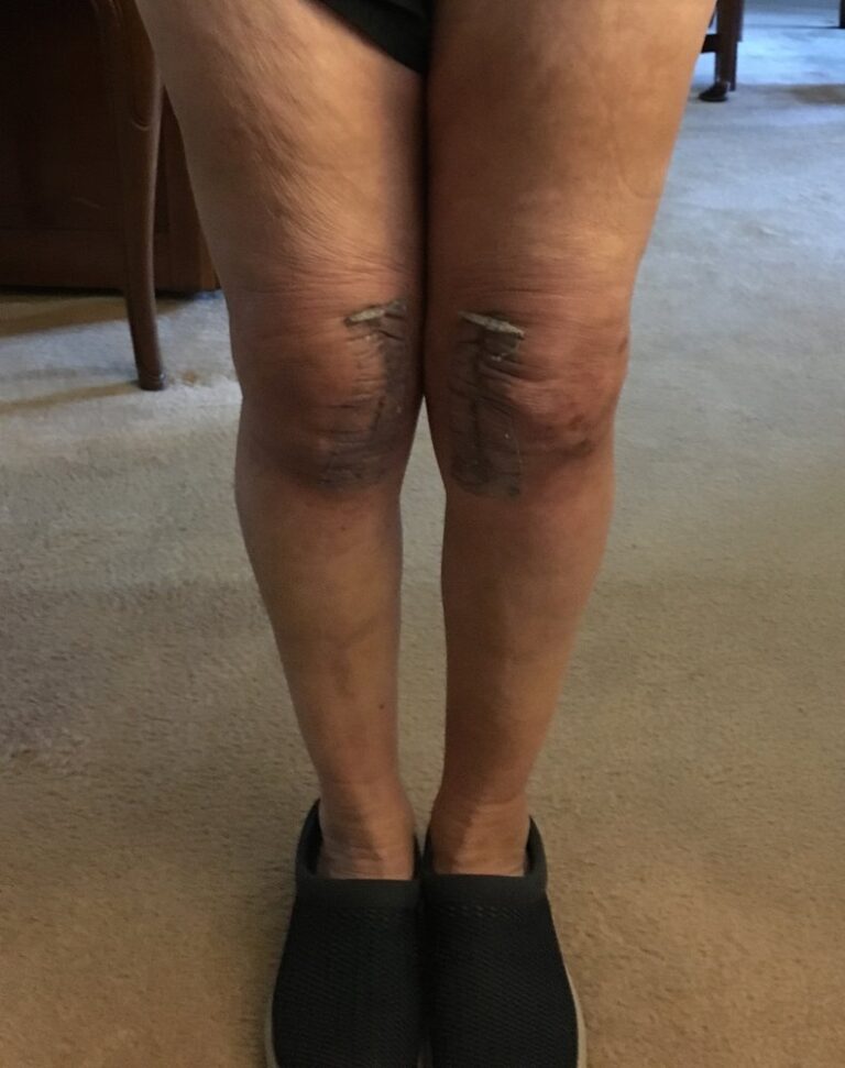 dearborn and associates institute for joint restoration menlo park 2