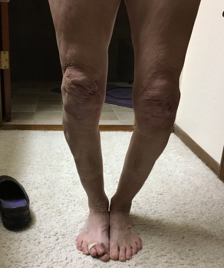 dearborn and associates institute for joint restoration menlo park 2