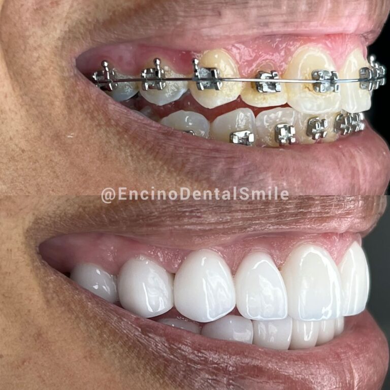 encino dental smile encino