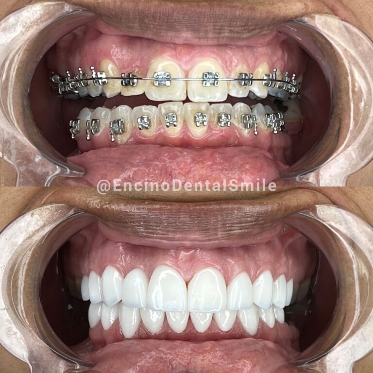 encino dental smile encino