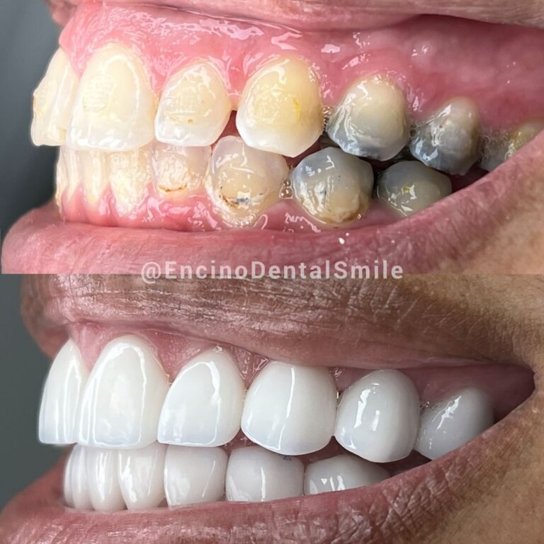 encino dental smile encino