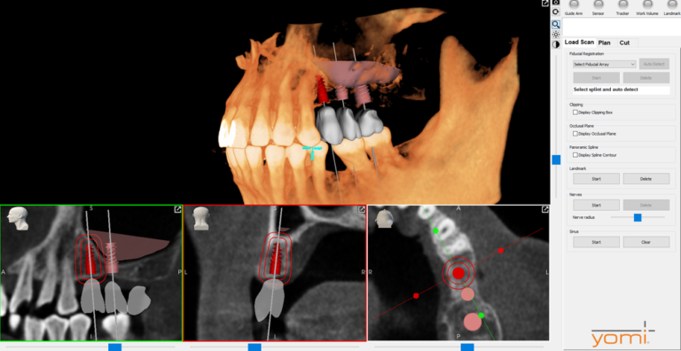 pierce aesthetics tustin