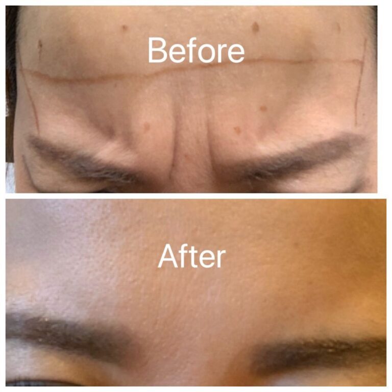 skin works medical spa torrance 2