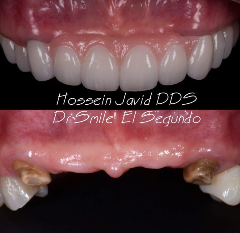 dr smile el segundo el segundo