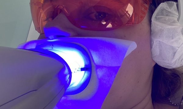 arthur glosman dds beverly hills 3