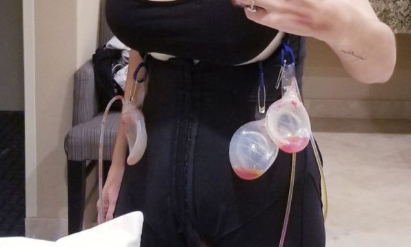 cosmetic plastic surgery institute newport beach 8