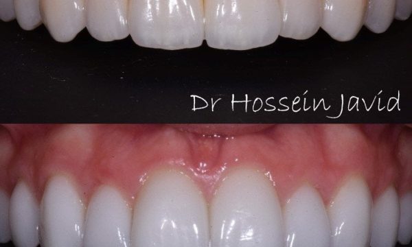 dr smile el segundo el segundo