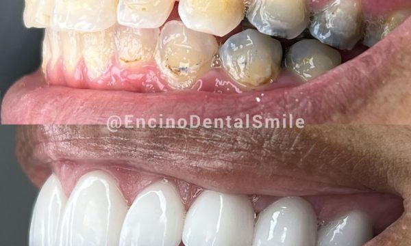 encino dental smile encino