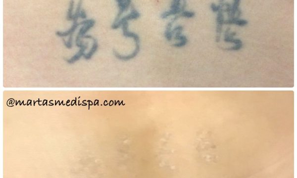 marta recasens medispa glendale 5