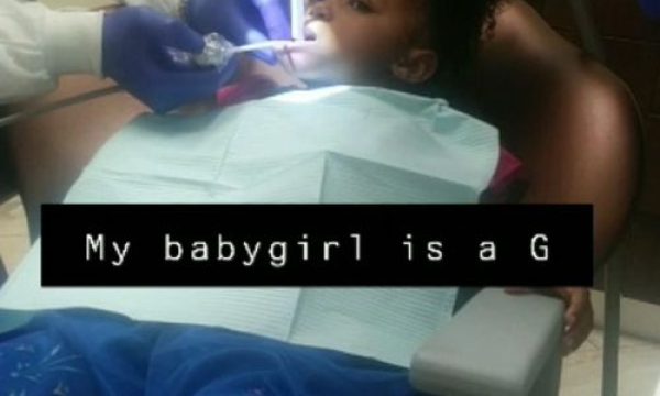 talent dental rancho cucamonga